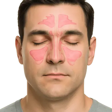 Ilustración anatómica del seno maxilar en hombre mostrando la ubicación del seno paranasal