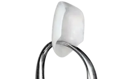 Carilla dental de porcelana colocada para mejorar la estética y el color del diente