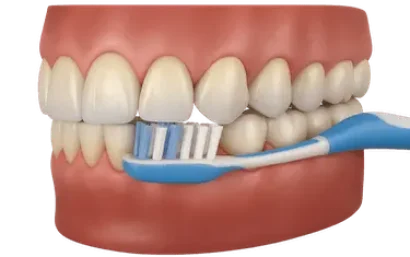 Cepillado dental correcto con técnica recomendada en la Clínica Dental Dr. Ferrer