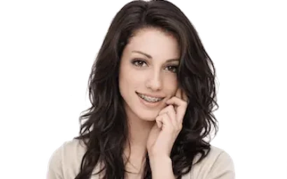 Paciente con ortodoncia sonriendo y buena higiene dental durante el tratamiento de ortodoncia