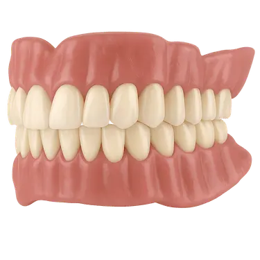 Prótesis dental completa mal ajustada que provoca sangrado e irritación de encías