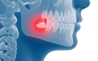 Ilustración que muestra el alivio del dolor de dientes y encías