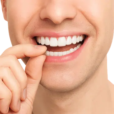 Férula transparente con gel para blanqueamiento dental en casa, tratamiento estético profesional