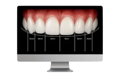 Tratamientos de estética dental en Madrid realizados por el Dr. Ferrer