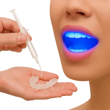 Blanqueamiento dental combinado en Madrid con luz LED y férulas personalizadas con gel blanqueador