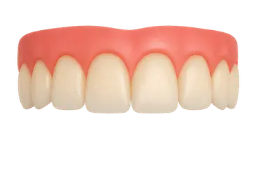 Dientes con fluorosis leve antes de un tratamiento de blanqueamiento dental en Madrid