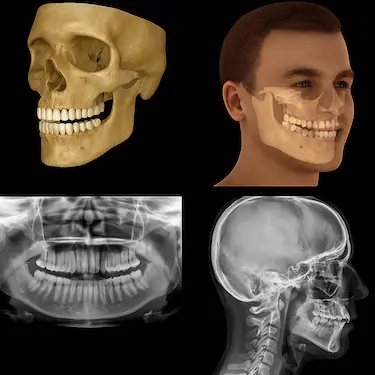 Imagen 3D de TAC dental con radiografía panorámica y modelos de prótesis en pantalla