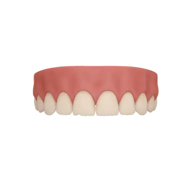 Desgaste leve dental por bruxismo leve sin rechinamiento, causado por presión continua