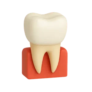 Ilustración de corona de zirconio cerámica sobre diente preparado