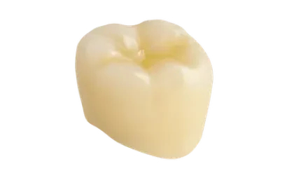 Corona dental con aspecto natural para restaurar dientes con una solución duradera y estética