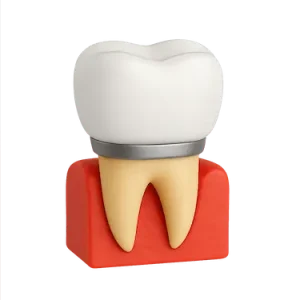 corona metal-porcelana mostrando núcleo metálico recubierto de cerámica