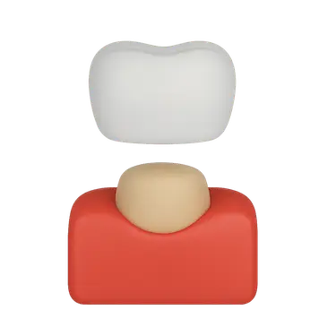 Corona provisional de resina sobre diente tallado en modelo dental 3D