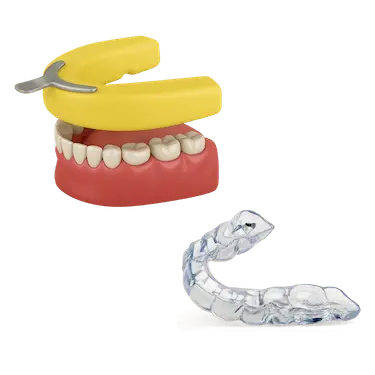 Proceso de fabricación de una férula dental personalizada