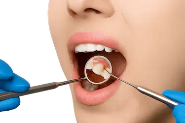 Revisión dental que puede provocar sensibilidad dental temporal tras la exploración