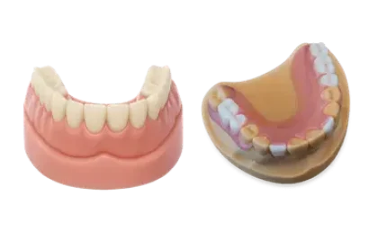Prótesis dentales en Madrid que muestran diferentes tipos de dentaduras completas y parciales
