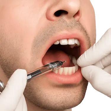 Aplicación de anestesia local antes de realizar un curetaje dental en clínica odontológica