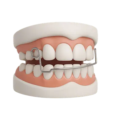 Aparato de Progenie usado en ortodoncia infantil para controlar el crecimiento mandibular