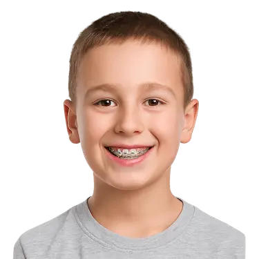 Niño sonriendo con brackets metálicos para alinear los dientes en ortodoncia infantil
