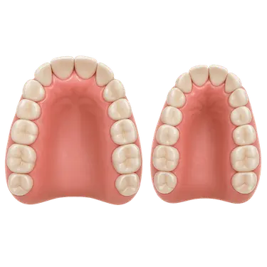 Vista superior de dos arcadas infantiles comparando un paladar estrecho con uno normal