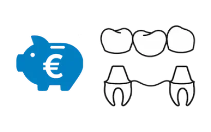 Prótesis dental sin implantes con puente fijo sobre dientes en clínica dental de Madrid