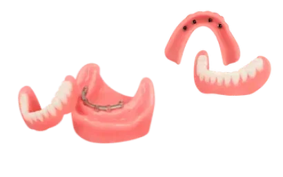 Tipos de prótesis dentales completas sobre implantes en Murcia usadas por el Dr. Ferrer