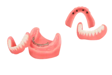 Tipos de prótesis dentales completas sobre implantes en Murcia usadas por el Dr. Ferrer