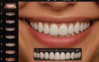 Tratamientos de estética dental en Murcia realizados por el Dr. Ferrer