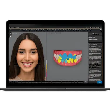 Plan de tratamiento de ortodoncia con simulación digital 3D en Madrid