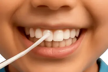 Aplicación de flúor dental en niño durante tratamiento preventivo en Clínica Dr. Ferrer Madrid