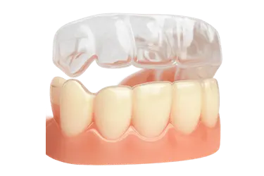 Tratamiento de ortodoncia invisible con alineadores transparentes en Madrid