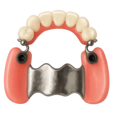 Prótesis parcial removible esquelética con ataches sin ganchos visibles y mayor estabilidad
