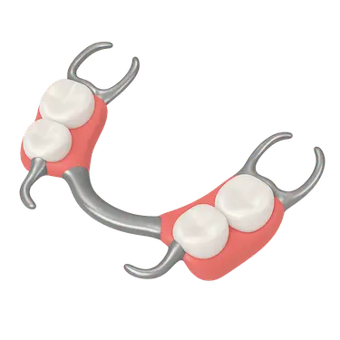 Prótesis parcial removible esquelética con estructura metálica y ganchos visibles en 3D