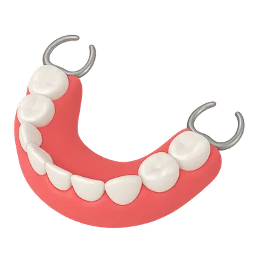 Prótesis dental parcial removible acrílica con ganchos metálicos en arcada inferior