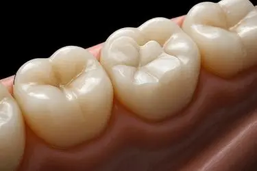 Empaste dental 3D tipo CAD-CAM que muestra la restauración del diente y su durabilidad
