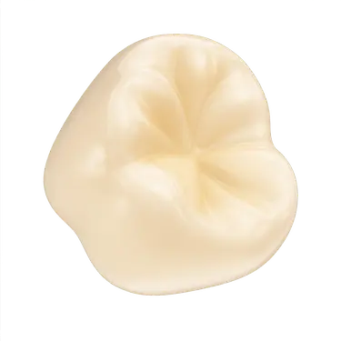 Funda dental de metal porcelana en representación 3D