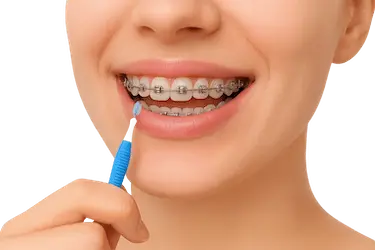 Paciente limpiando brackets autoligables con cepillo interdental durante higiene en ortodoncia