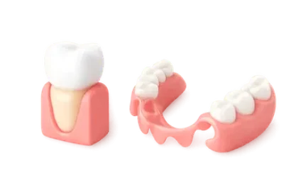 Corona dental y prótesis parcial sin implantes en clínica dental de Murcia