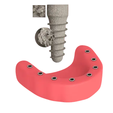 Proceso de osteointegración del implante dental en la mandíbula