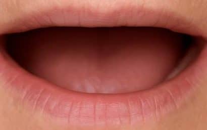 boca sin dientes, antes de colocar una prótesis híbrida sobre implantes