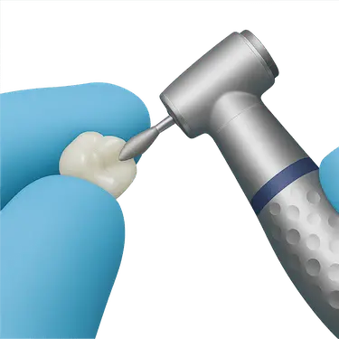 prueba y ajuste de una corona sobre implante para asegurar encaje, estética y correcta oclusión