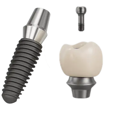 Corona sobre implante en Murcia con pilar metálico y corona de porcelana o zirconio