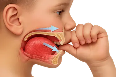 Niño chupándose el dedo, hábito que puede alterar el crecimiento del paladar infantil