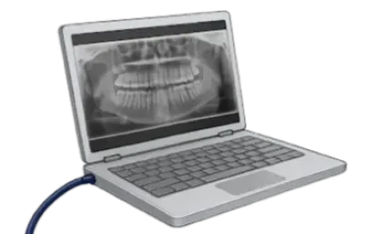 Ordenador con radiografía dental para pedir presupuesto clínica dental Dr. Ferrer por internet.