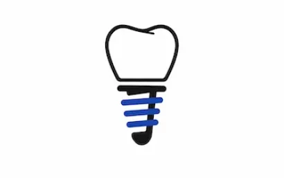 Tarifas de implantes dentales en la clínica dental del Dr. Ferrer