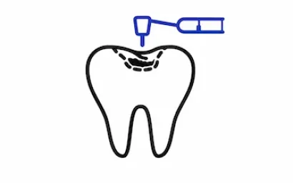 Tarifas de odontología general en la clínica dental del Dr. Ferrer