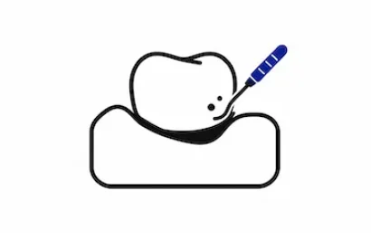 Tarifas de periodoncia en la clínica dental del Dr. Ferrer