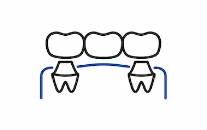 Tarifas de prostodoncia y prótesis en la clínica dental del Dr. Ferrer