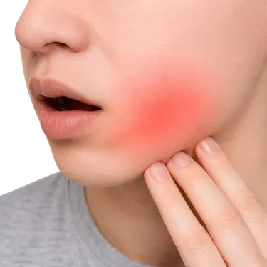 Paciente con dolor facial por absceso dental atendido por dentista de urgencia en Murcia