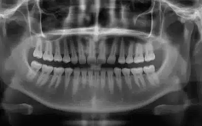 Presupuesto dental con radiografía en la Clínica Dental Medics Dr. Ferrer