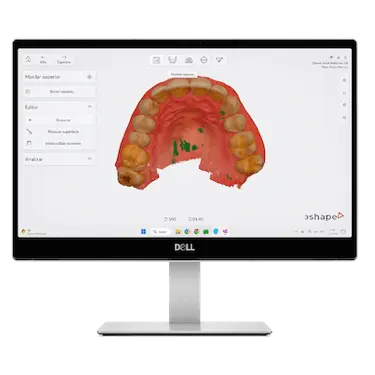 Toma de medidas digital para férula de apnea del sueño con escáner intraoral y software dental